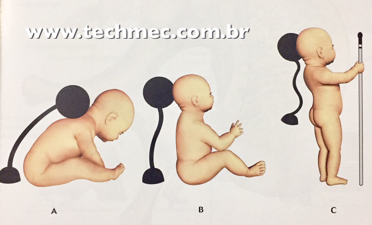 Formação Das Curvaturas Da Coluna Vertebral Techmec 